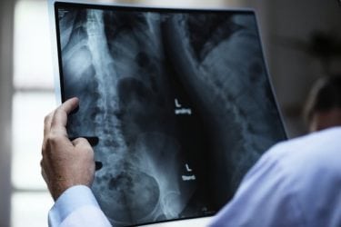 Physician analyzing a scan of a patient, representing the importance of early mesothelioma screening.